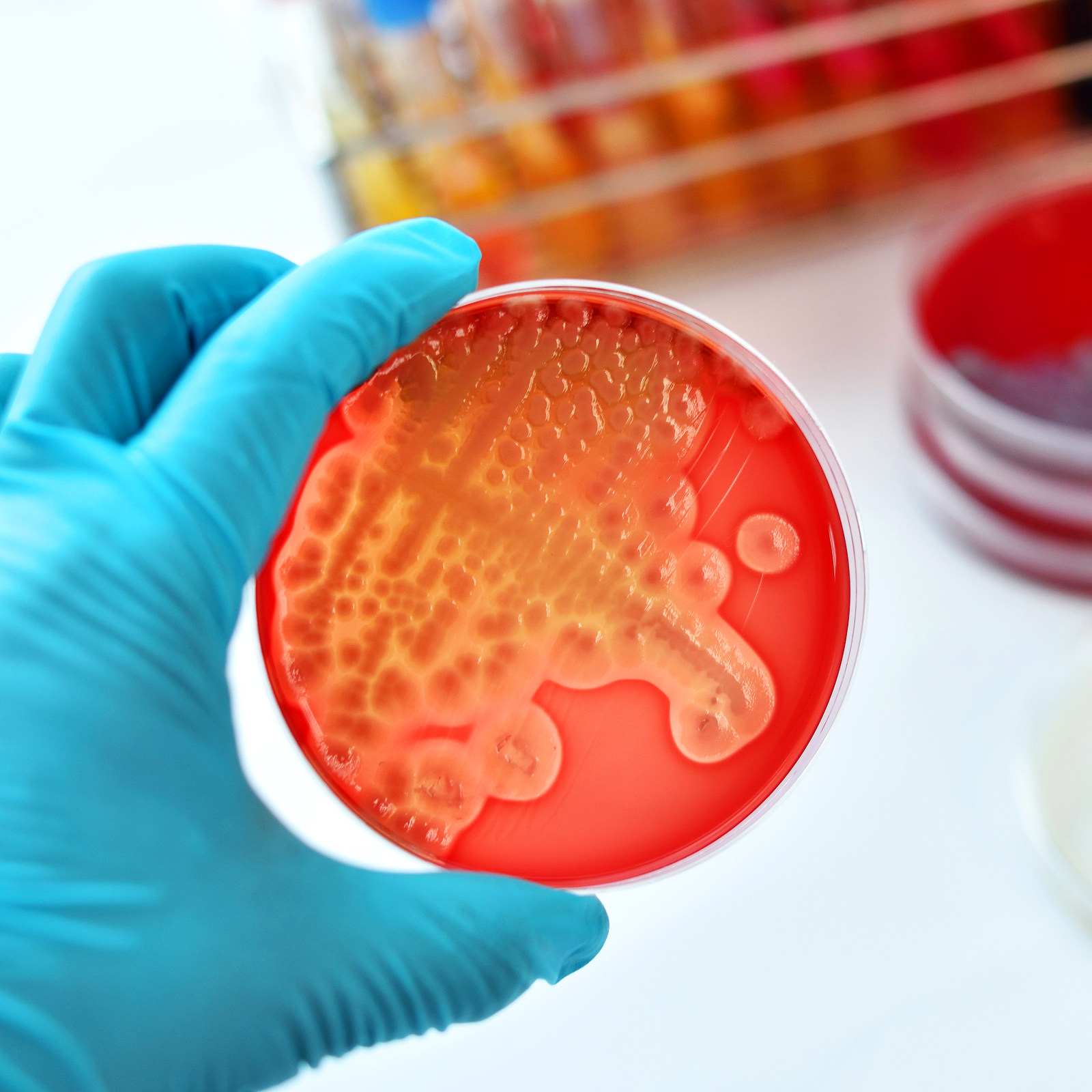 Agar Tissue Culture - 20Pcs Agar Petri Plates Pre-Poured Nutrient